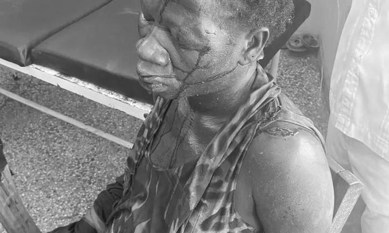 Pregnant woman battles for life after being butchered by husband in Nchumuru