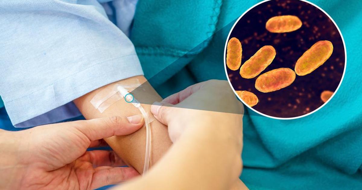 Here are guidelines to prevent catheter infections by WHO | Pulse Ghana
