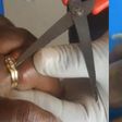 Woman almost lost finger after wearing wedding ring bought from her friend