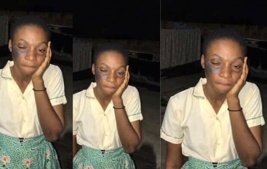 Female student goes partially blind after slap by Nkwatia Presby SHS headmaster