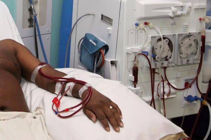 Kidney disease: Akufo-Addo directs Health Ministry to migrate dialysis costs onto NHIS