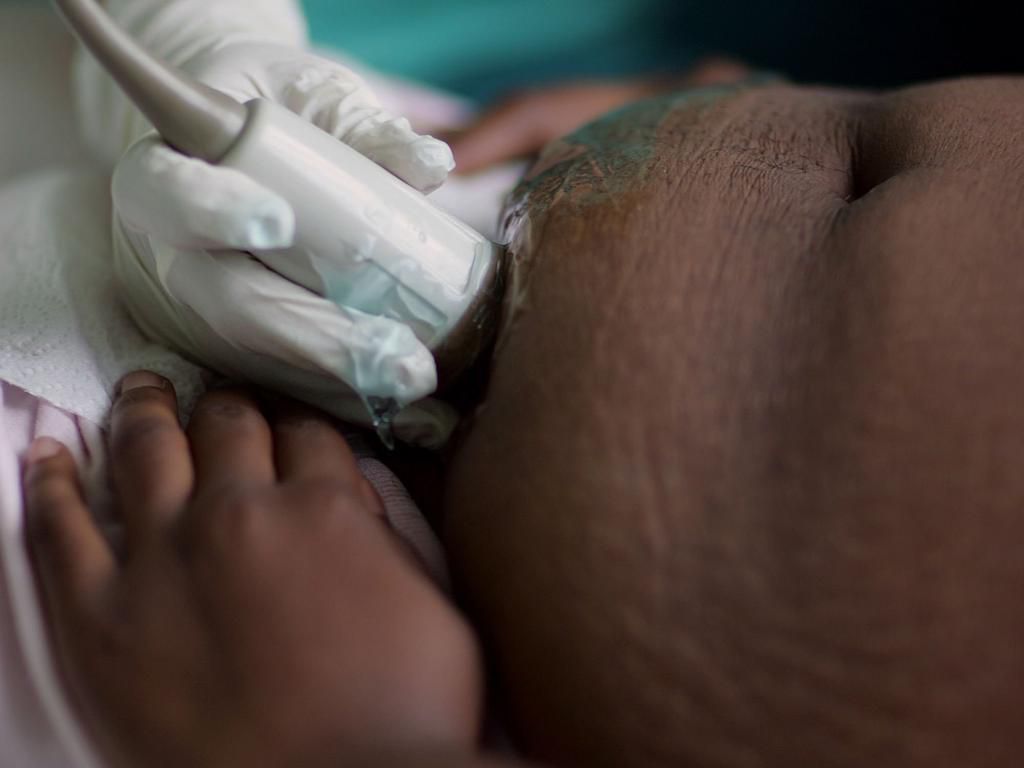 pregnant woman ultrasound