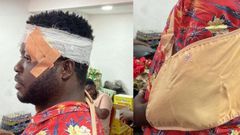 TESCON member injured