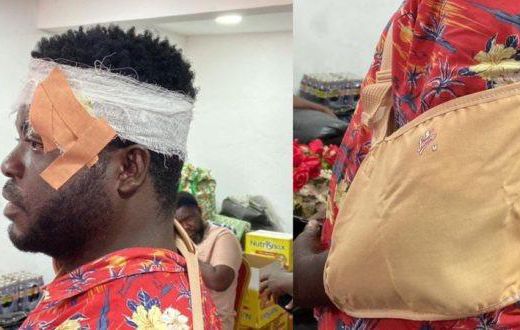 TESCON member injured