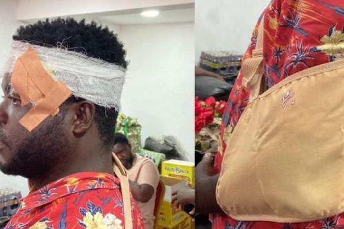 TESCON member injured