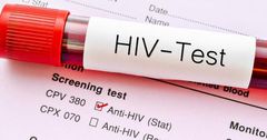 Very few people in Ghana have taken HIV tests