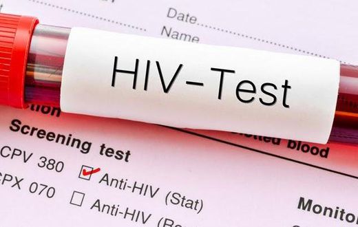 Very few people in Ghana have taken HIV tests
