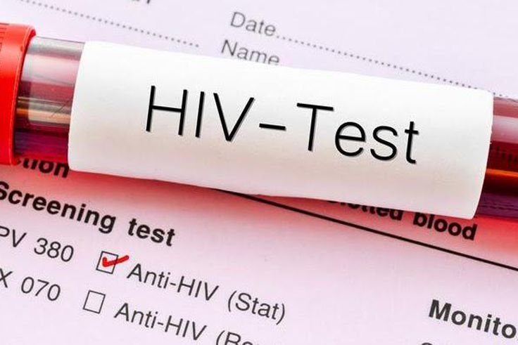 Very few people in Ghana have taken HIV tests