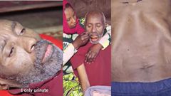Driver suffering from strange illness eats daily but hasn’t defecated for 13 years
