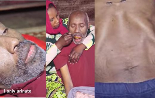 Driver suffering from strange illness eats daily but hasn’t defecated for 13 years