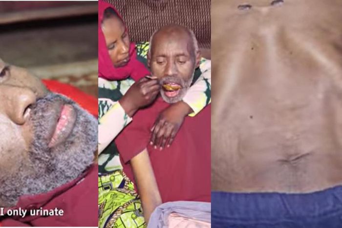 Driver suffering from strange illness eats daily but hasn’t defecated for 13 years