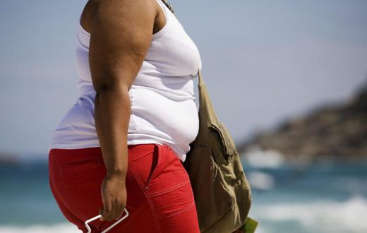 An obese woman