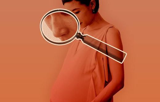 Luckily, the nose returns to its normal size after childbirth [Allure]