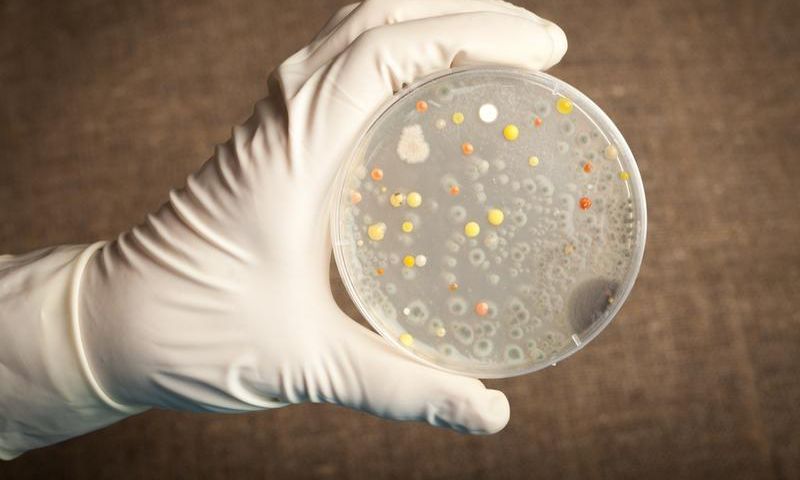Anthrax Disease