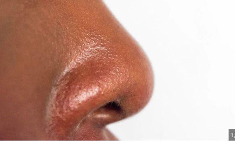 Treating oily nose