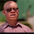 Director of the association of persons with albinism in Ghana, Newton Katseku