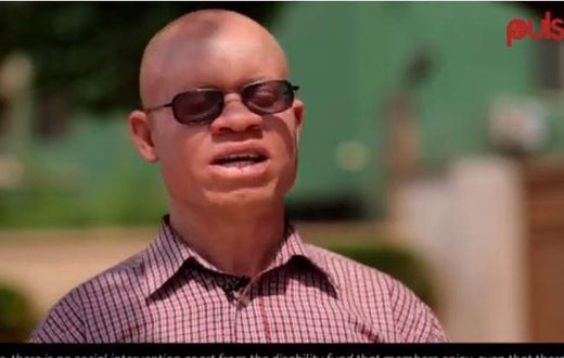 Director of the association of persons with albinism in Ghana, Newton Katseku