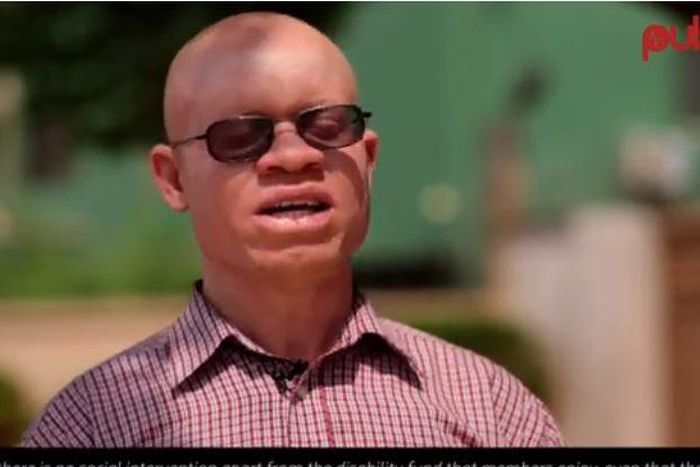 Director of the association of persons with albinism in Ghana, Newton Katseku