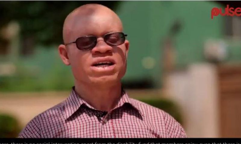 Director of the association of persons with albinism in Ghana, Newton Katseku