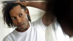 For Men: Find out if your hairline is receding before it's too late