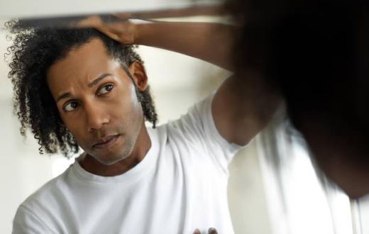For Men: Find out if your hairline is receding before it's too late