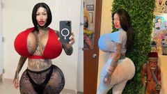 I feel trapped; model with multiple enhancement surgeries shares regret and pain (PHOTOS)