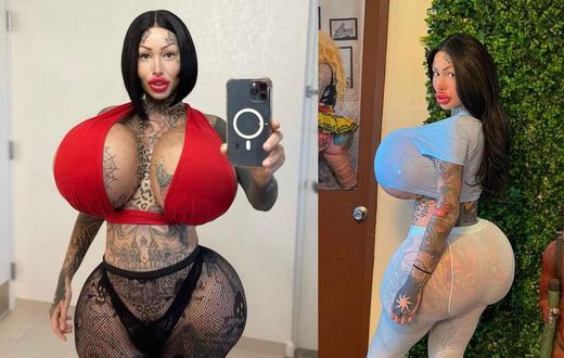 I feel trapped; model with multiple enhancement surgeries shares regret and pain (PHOTOS)