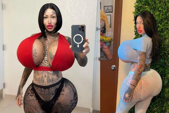 I feel trapped; model with multiple enhancement surgeries shares regret and pain (PHOTOS)