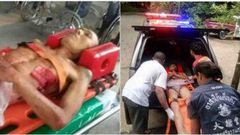 Man angrily cuts off his penis after beautiful lady rejected his proposal (photos)