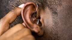 Hearing aid [UF Health]