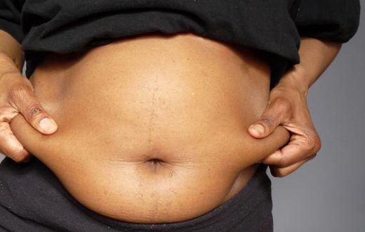 Belly fat