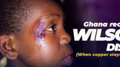 Ghana's first Wilson's disease patient struggles for treatment amid financial hardship