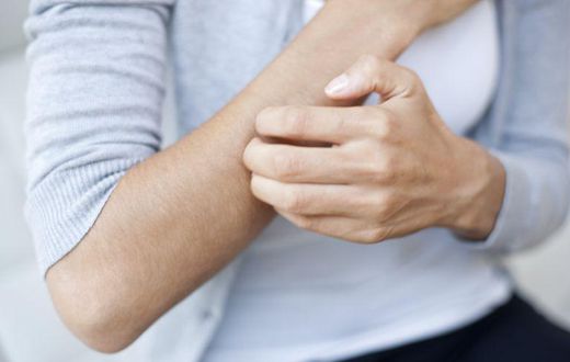 Woman scratching her arm