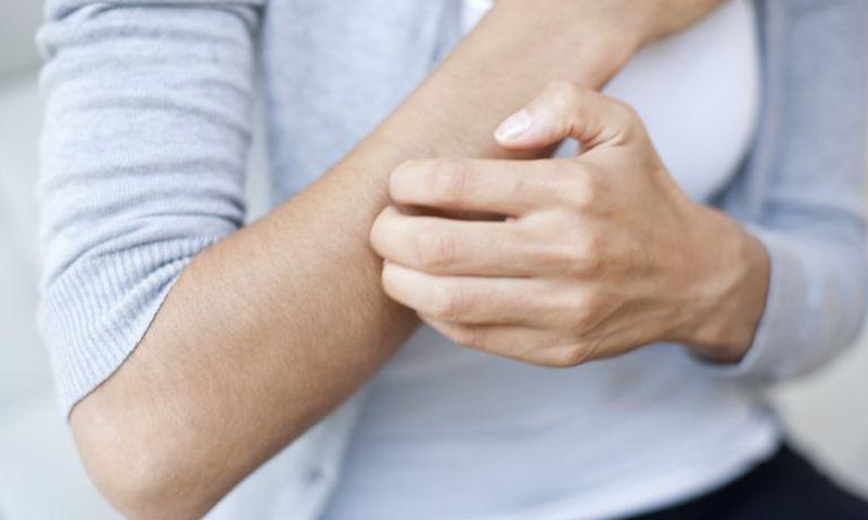 Woman scratching her arm