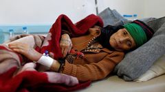 7 heartbreaking images show why US lawmakers want to stop supporting the brutal Saudi-led war in Yemen that's seen indiscriminate attacks and left millions at the brink of famine