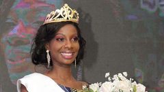 Nana Ama Benson, a 23-year-old graduate of the University Ghana Nursing School  who represented  the Central Region has been crowned Miss Ghana 2018.