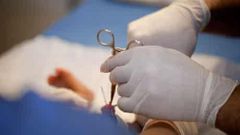 Men can be circumcised even at 50 years - Health practitioner shares more insight