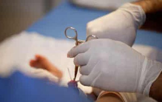Men can be circumcised even at 50 years - Health practitioner shares more insight