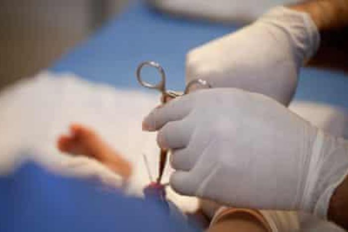 Men can be circumcised even at 50 years - Health practitioner shares more insight