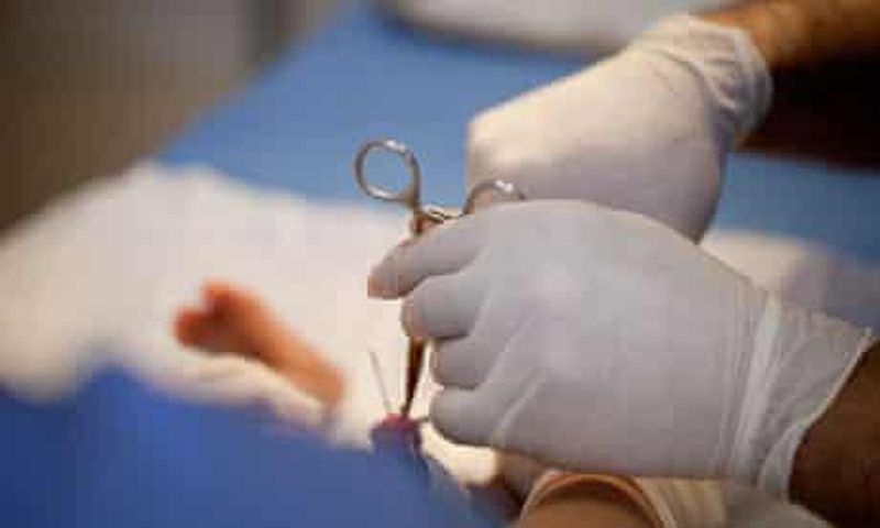 Men can be circumcised even at 50 years - Health practitioner shares more insight