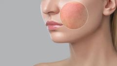 skin-barrier