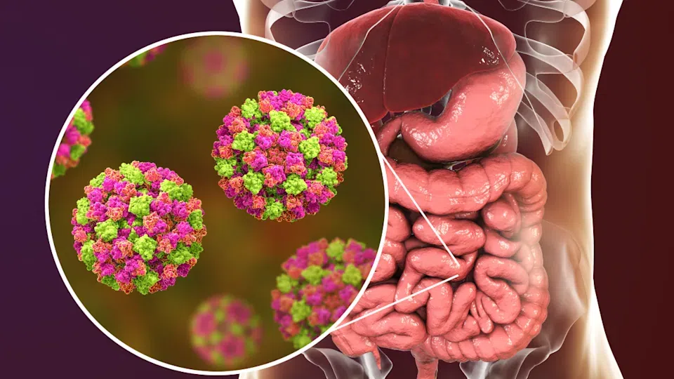 stomach-flu