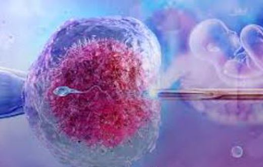 IVF