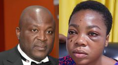 Ablakwa visits Suzy Pinamang in London, provides update on her eye injury treatment