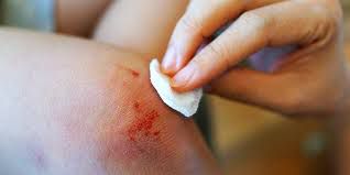 open-wound