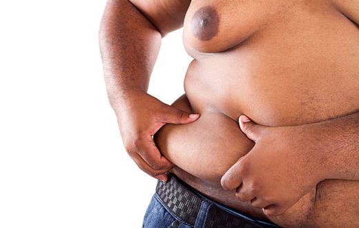 Obesity can lead to serious health problems if not addressed [iStock]