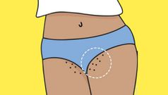 If the skin in your private area is exposed to friction it can thicken and darken overtime [Medium]