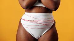 Why is your private area darker than the rest of you? [ElleIndia]