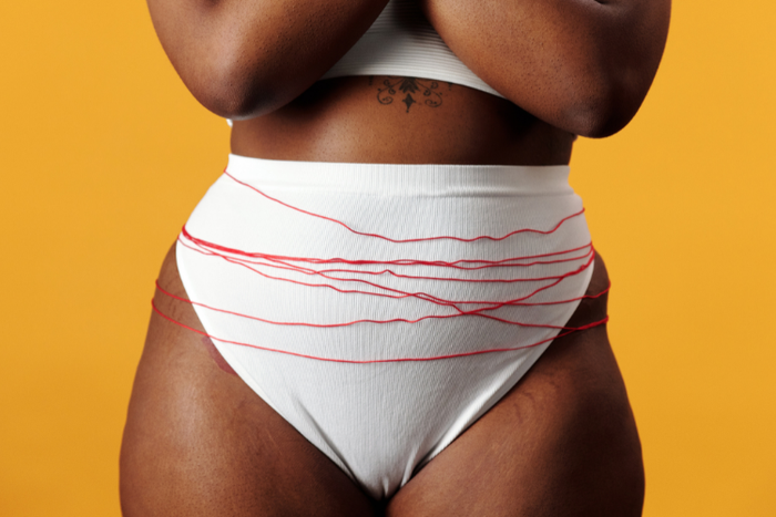 Why is your private area darker than the rest of you? [ElleIndia]