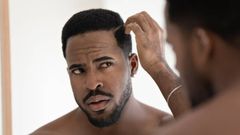 What are the causes of dandruff [iStock]